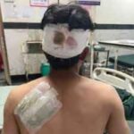 यूवक पर भालू ने किया जानलेवा हमला… पढ़िए कैसे बचाई अपनी जान … यूवक पर भालू ने किया जानलेवा हमला… पढ़िए कैसे बचाई अपनी जान …