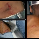 एक दूसरे को घायल कर थाने पहुंचें नशा तस्करों के लोग…